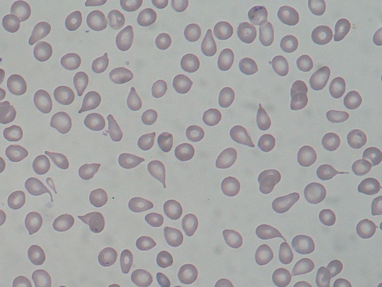 Red Circle with White Teardrop Logo - Dacrocyte