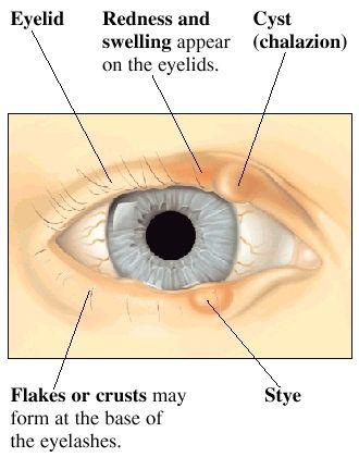 Eye Triangle Physiciqns Logo - Blepharitis Eye Physicians