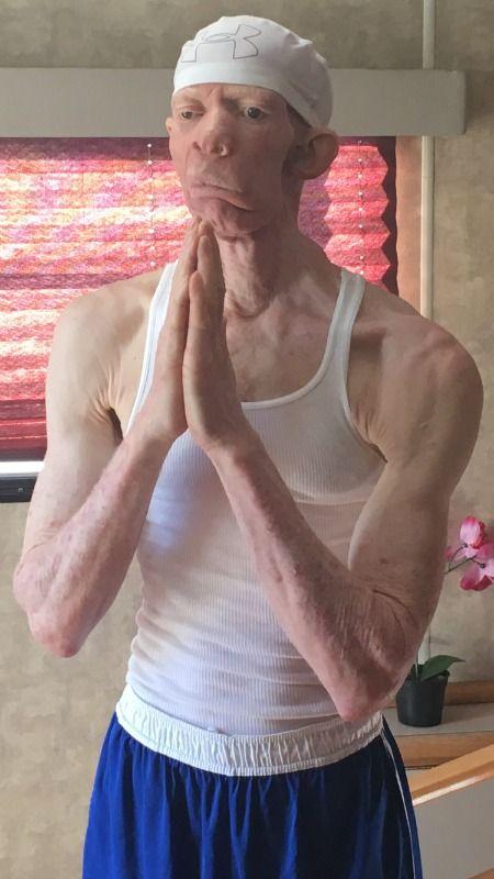 Yellowman Sun Logo - King Yellowman defends gay rights at Reggae on the MountainLos ...