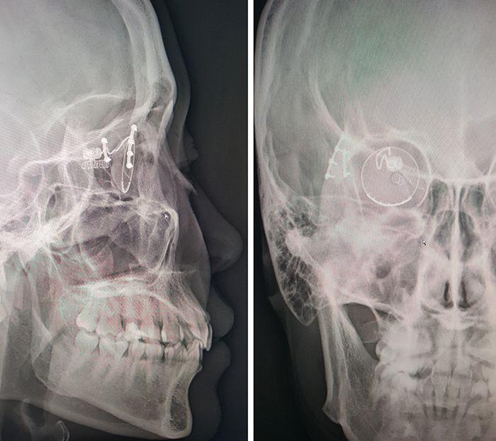 Crazy Apple Logo - The Internet Is Going Crazy Over These 'Apple Eye' X Rays