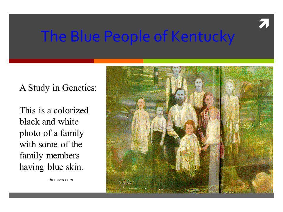 White with Blue People Logo - The Blue People of Kentucky A Study in Genetics: This is a colorized ...