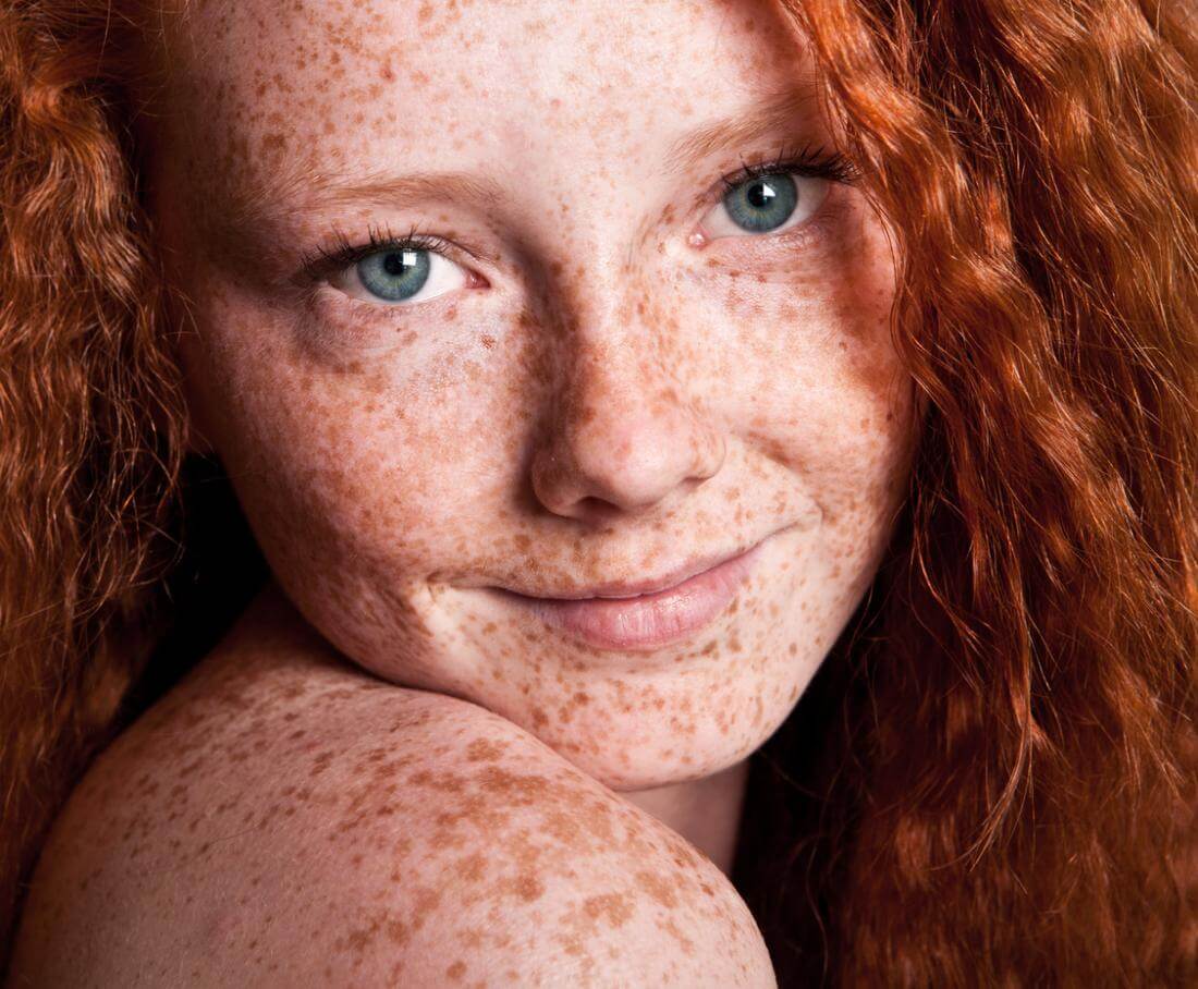 Red Hair and Face Logo - Are We In Danger Of Losing Blue Eyed Redheads? Not Likely. Genetic