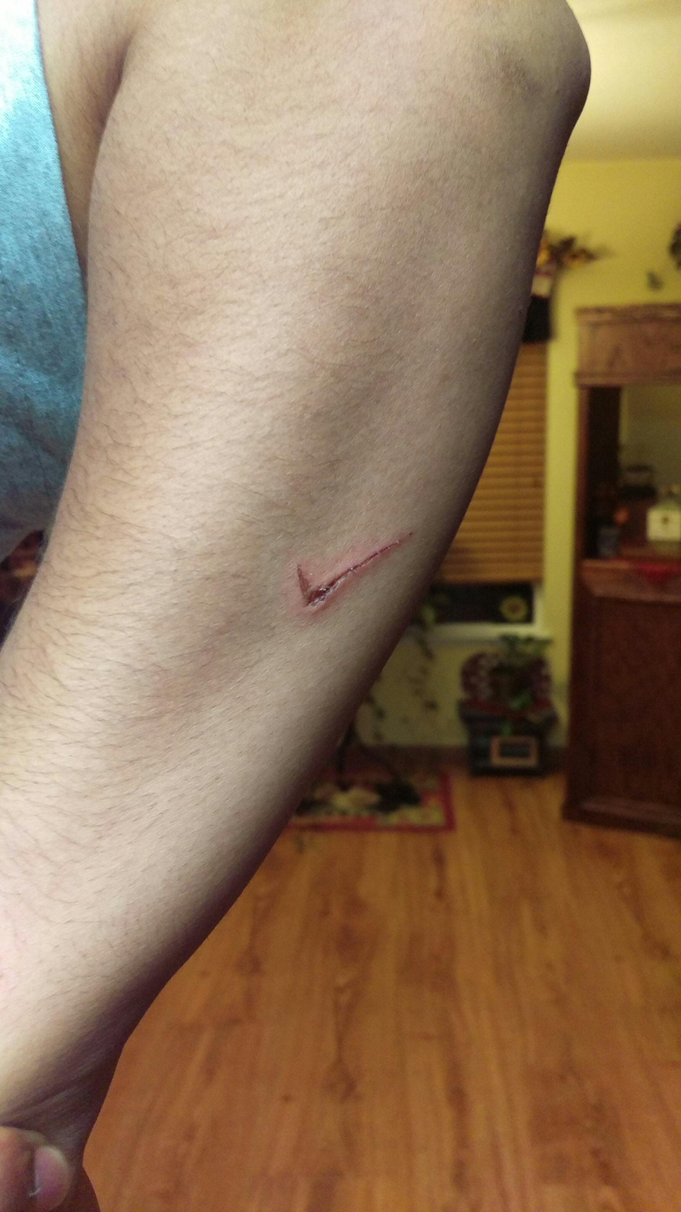 Brown Nike Logo - My cut on my arm looks like the Nike logo