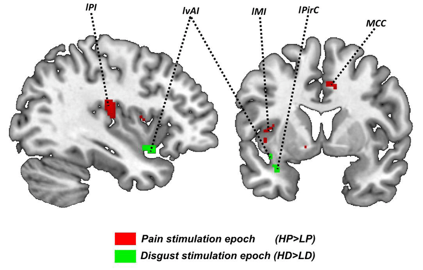 Red Blobs Logo - Neural responses to pain (red blobs) and disgust (green blobs