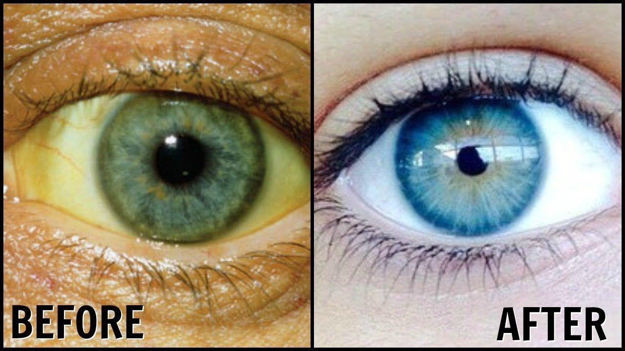 Blue and White Eye Logo - How To Whiten the Whites Of Your Eyes Naturally! │ Get Rid of Dull
