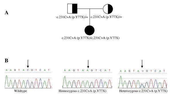 Pomc Logo - Patient pedigree and POMC gene mutation analysis. (A) Pedigree of ...