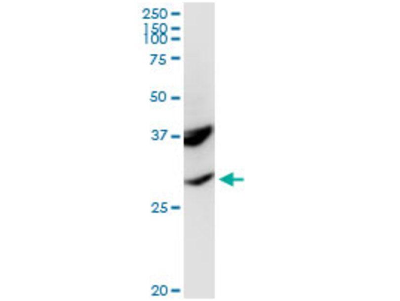 Pomc Logo - Anti-Human POMC antibody for Immunoprecipitation (IP)