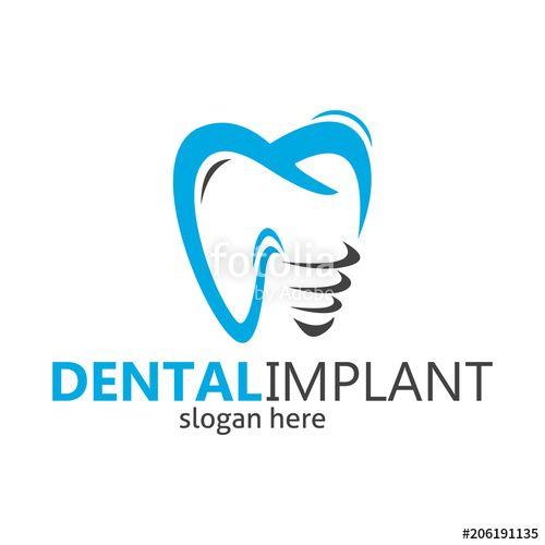 Implant Logo - dental braces logo, dental implant, dental logo design Stock image