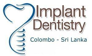 Implant Logo - Tooth Implant Logo by Zavion Heller | Places to Visit | Pinterest ...