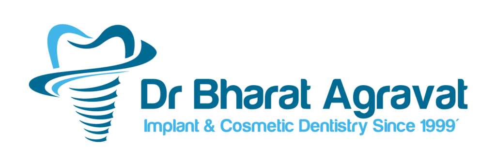 Implant Logo - Top Cosmetic and Implants Dental Care in Ahmedabad, Gujarat