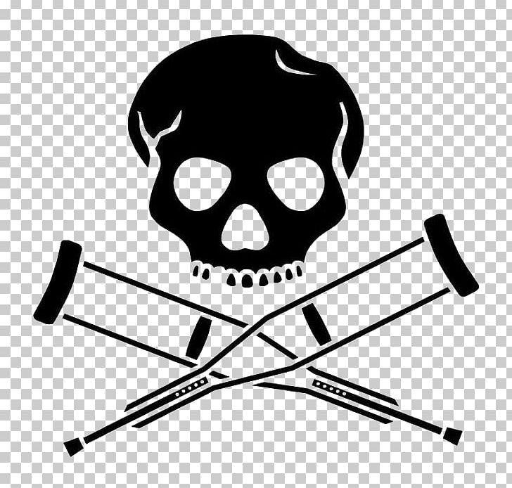 Jackass Logo - Logo Jackass MTV PNG, Clipart, Angle, Black, Black And White, Bone