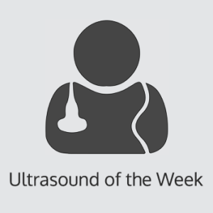 Ultrasound Logo - Ultrasound Podcast – Making horrible doctors decent and good doctors ...