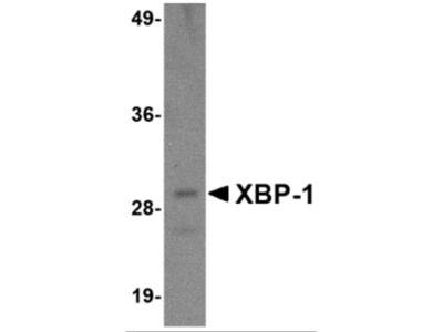 Xbp Logo - Anti XBP 1 Antibody Products