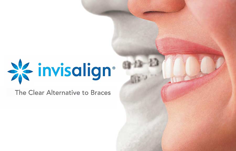 Invisalign Logo - invisalign-logo - Relaxation Dentistry