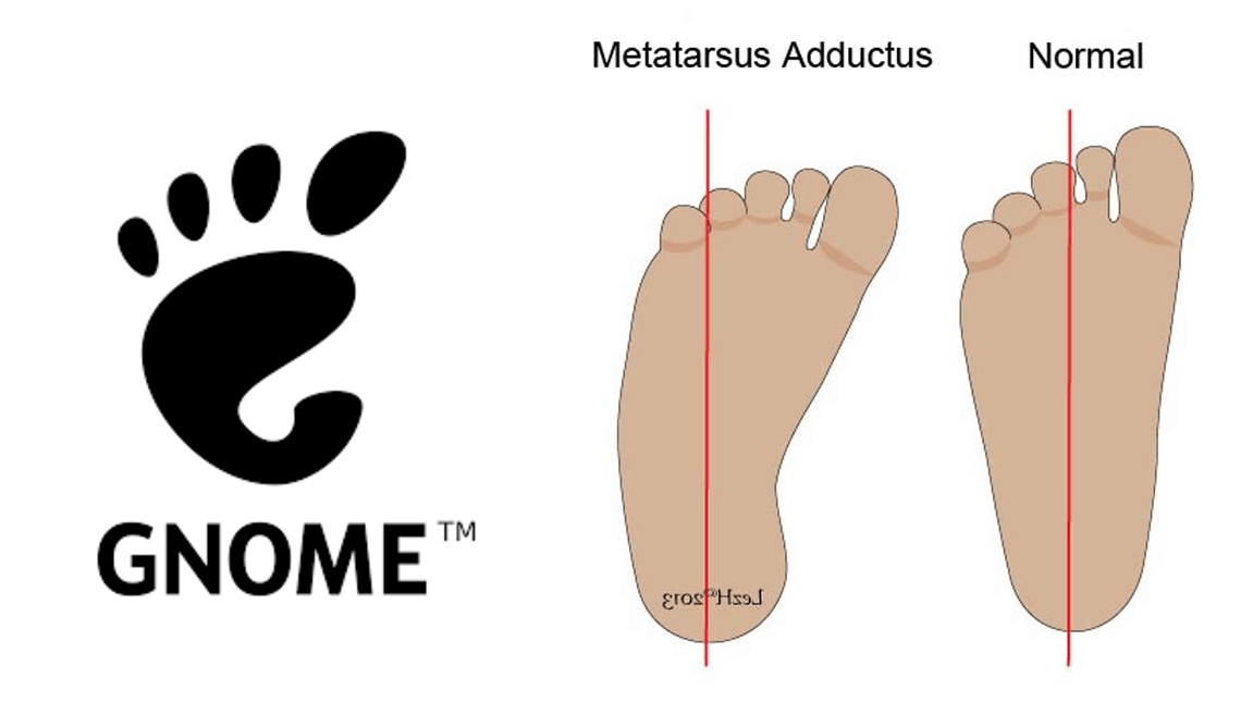 Gnome Logo - The foot in Gnome logo can be diagnosed with Metatarsus Adductus