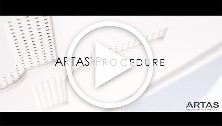 Artas Logo - The ARTAS Robotic Hair Transplant