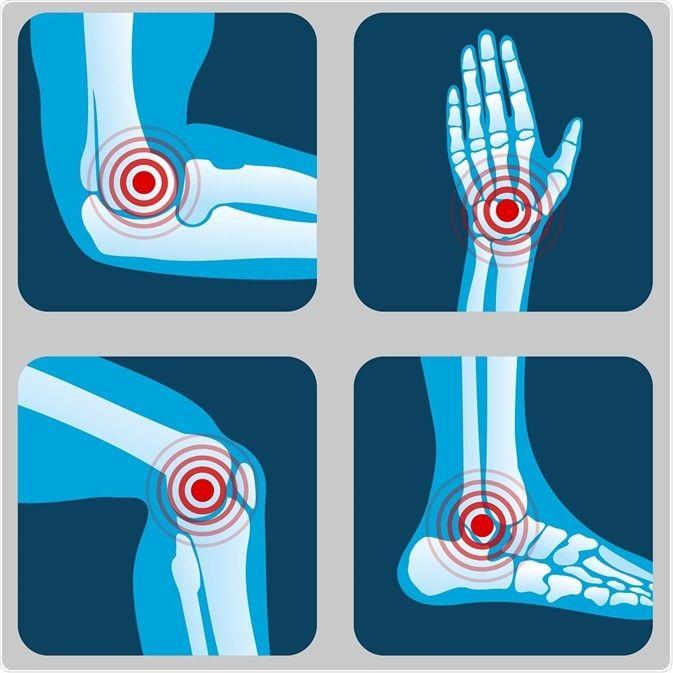 Arthritis Logo - Types of Arthritis