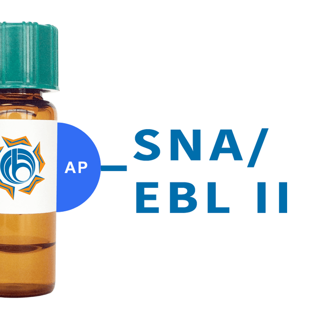 Rhodam Logo - Sialic Acid Binding Lectins