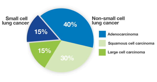 Sclc Logo - Types of Lung Cancer | Lung Cancer Foundation of America