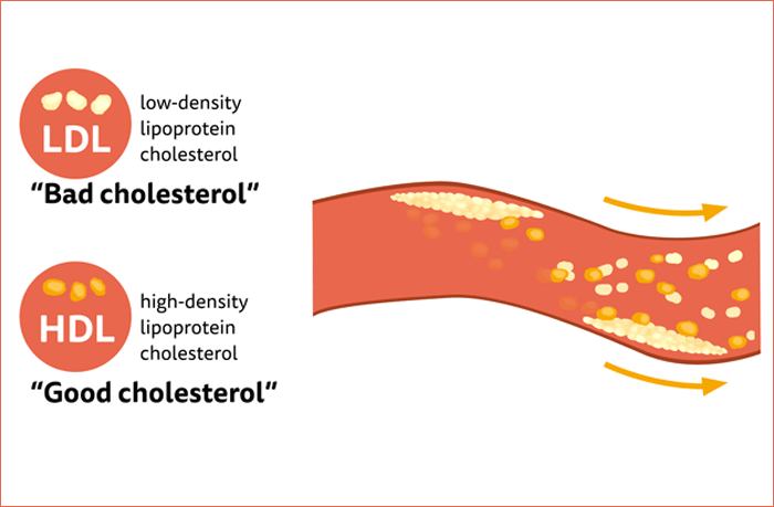 Cholesterol Logo - Scientific concept: good vs. bad cholesterol | JustStand.org