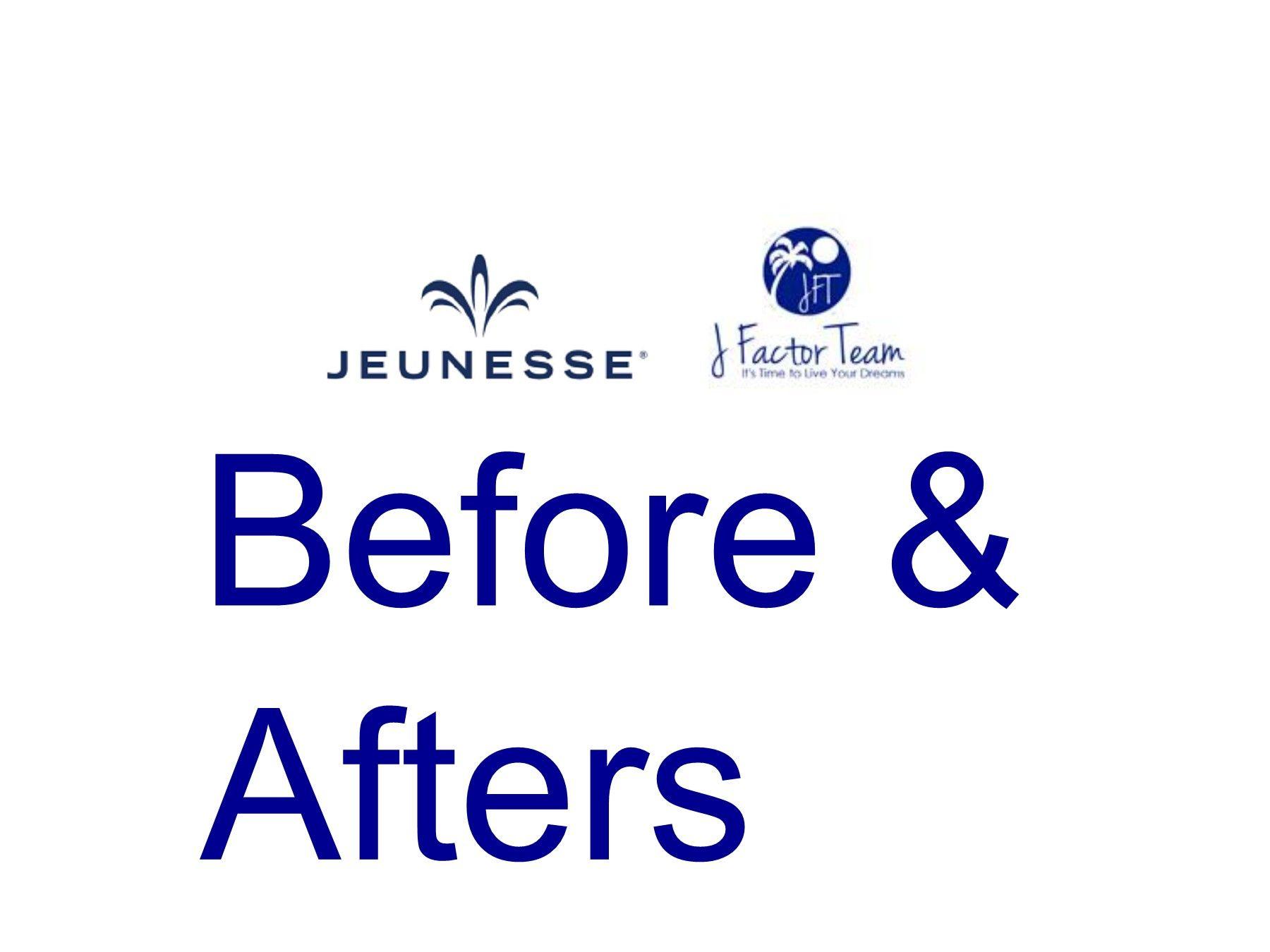 Luminesce Logo - Jeunesse Global Before and Afters for Instantly Ageless and Luminesce