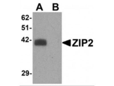 Zip2 Logo - Anti ZIP2 Antibody Products