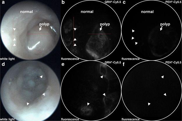 White Circle Red Colon Logo - In vivo imaging of colon in CPC;Apc mouse. (a) White-light image of ...