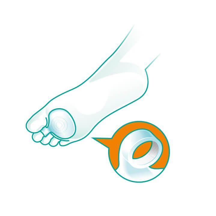 Oppo Medical Logo - Oppo Medical Silicone Metatarsal Pads · Dunbar Medical