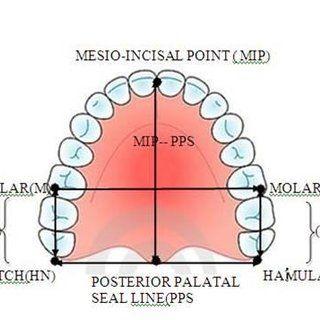 Red MP Arch Logo - Measurement of maxillary arch | Download Scientific Diagram