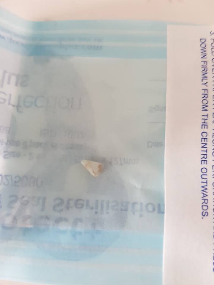 Vampire Mom Fang Logo - This Mom Got Worried When Her 2-Month Old Baby Grow A Tooth, A Sharp ...