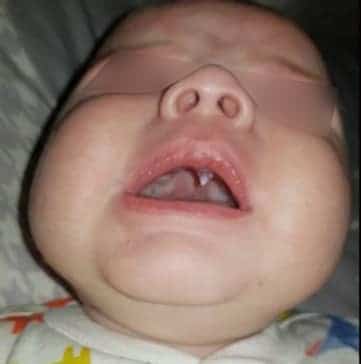 Vampire Mom Fang Logo - Mom Freaks Out When 2-Month-Old Grows A Fang Overnight - Elite Readers