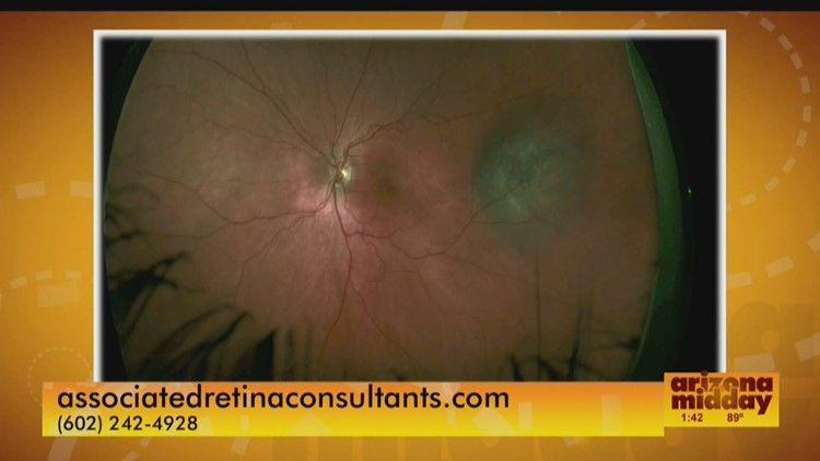 Associated Retinal Consultants Logo - Associated Retina Consultants | 12news.com