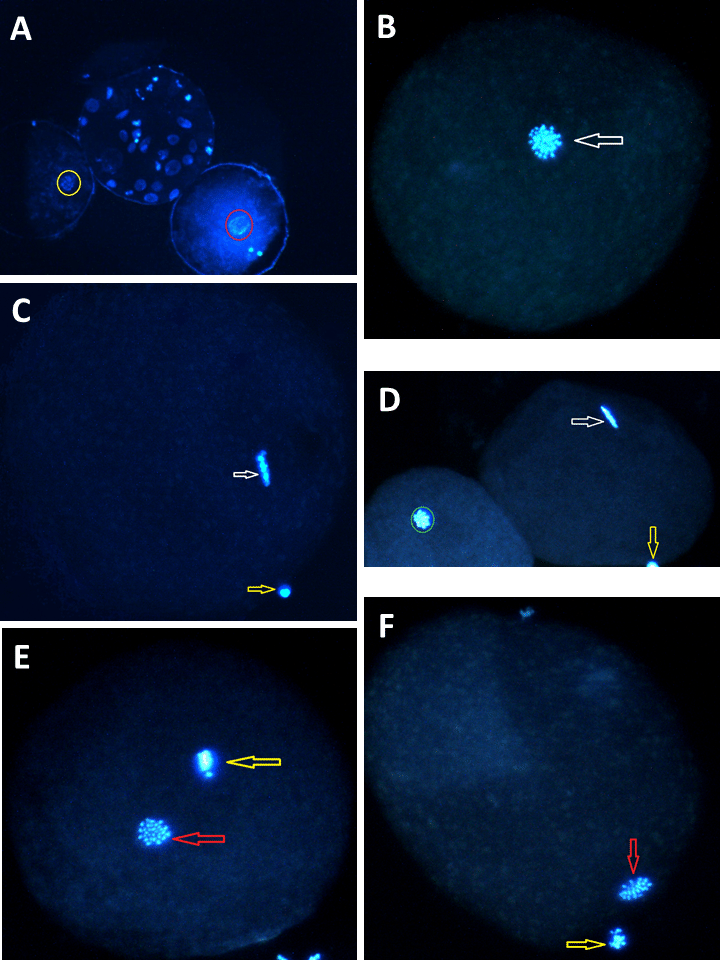 Space with Blue Red Circle Logo - A) A yellow circle shows germinal vesicle (GV); a red circle shows ...