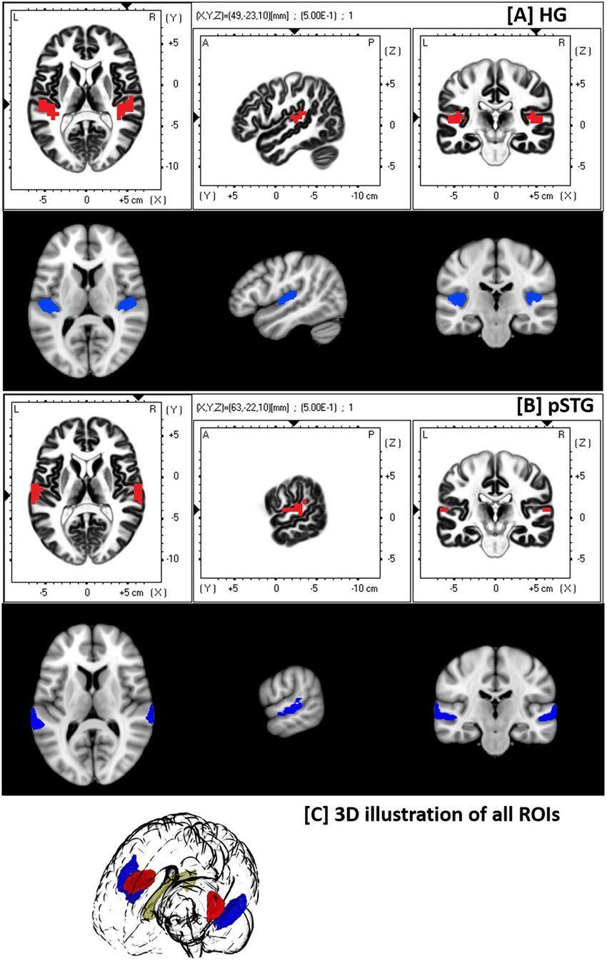 Space with Blue Red Circle Logo - White background (red): EEG-ROIs created in LORETA in standard space ...