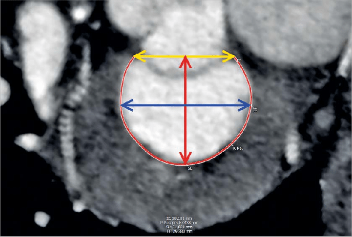 Arrow-Shaped Red Face Logo - En face view of a segmented 