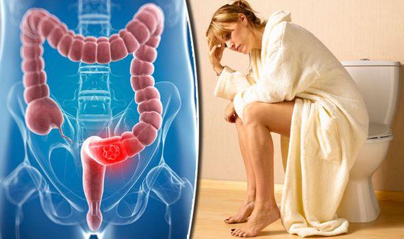 Colon White with Red Ball Logo - Bowel cancer symptoms: Signs of disease similar to PILES | Express.co.uk